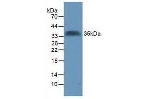 Detection of Recombinant Tomoregulin, Human using Polyclonal Antibody to Tomoregulin (TR)