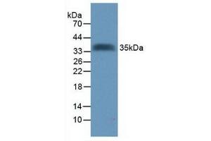 Detection of Recombinant Tomoregulin, Human using Polyclonal Antibody to Tomoregulin (TR) (TMEFF2 anticorps  (AA 52-290))