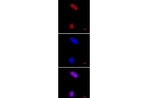 Histone H3K27me3 pAb tested by immunofluorescence. (Histone 3 anticorps  (3meLys27))
