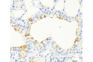 Immunohistochemistry of paraffin-embedded Mouse bronchus using MAPRE3 Polyclonal Antibody at dilution of 1:100 (40x lens). (MAPRE3 anticorps)