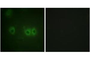 Immunofluorescence analysis of HuvEc cells, using MRLC2 (Ab-18) Antibody. (MYL12B anticorps  (AA 3-52))