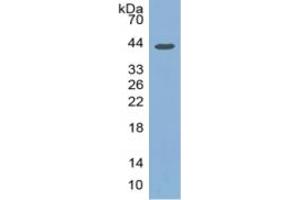 WB of Protein Standard: different control antibodies against Highly purified E.