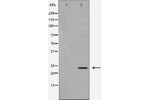 Western blot analysis of A431 cell lysate, using IL24 Antibody. (IL-24 anticorps  (Internal Region))