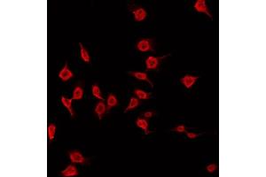 ABIN6266820 staining Hela by IF/ICC. (MAST3 anticorps  (Internal Region))