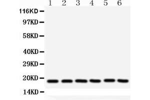 Western blot analysis of SOD1 using anti- SOD1 antibody . (SOD1 anticorps  (C-Term))