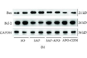 Nox hyperactivity contributes to cardiomyocyte apoptosis in SAP rats.