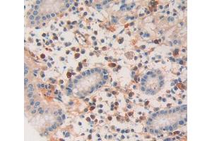 IHC-P analysis of Kidney tissue, with DAB staining. (DNAJC2 anticorps  (AA 442-621))