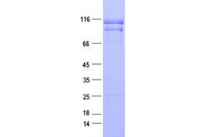 Validation with Western Blot