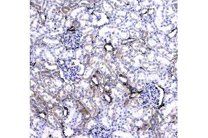 IHC analysis of CD44 using anti-CD44 antibody .