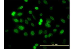 Immunofluorescence of monoclonal antibody to ZNF21 on HeLa cell. (ZNF182 anticorps  (AA 81-190))