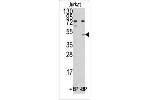 anti-MYC Induced Nuclear Antigen (MINA) (C-Term) antibody