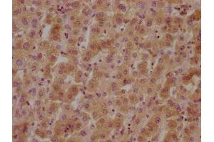IHC image of ABIN7140074 diluted at 1:800 and staining in paraffin-embedded human liver tissue performed on a Leica BondTM system.