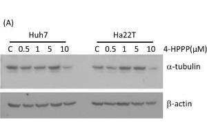 The effect of 4-HPPP on tubulin expression of HCC cells. (TUBA1B anticorps)