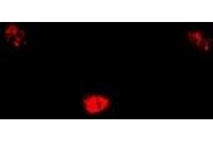 Immunofluorescent analysis of SIN3A staining in U2OS cells.