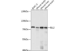 anti-Elongation Factor, RNA Polymerase II, 2 (ELL2) (AA 253-352) antibody