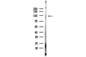 anti-Epidermal Growth Factor Receptor Pathway Substrate 15 (EPS15) (pTyr849) antibody