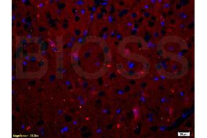 Formalin-fixed and paraffin embedded rat brain tissue labeled with Anti-RANK/CD265 Polyclonal Antibody, Unconjugated (ABIN749258) at 1:200 followed by conjugation to the secondary antibody, Goat Anti-Rabbit IgG, Cy3 conjugated, and DAPI staining