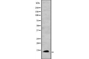 Western blot analysis of CCL24 expression in HEK293 cells ,The lane on the left is treated with the antigen-specific peptide.