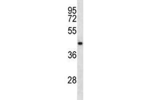 NDRG2 antibody western blot analysis in CEM lysate.