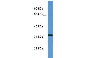 WB Suggested Anti-ZAP70 Antibody Titration: 1. (ZAP70 anticorps  (N-Term))
