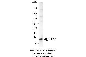 Image no. 1 for anti-SRA Stem-Loop Interacting RNA Binding Protein (SLIRP) (C-Term) antibody (ABIN363541) (SLIRP anticorps  (C-Term))