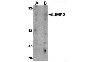 Western blot analysis of LIMP2 in human skeletal muscle tissue lysate with this product at (A) 1 and (B) 2 μg/ml. (SCARB2 anticorps  (C-Term))