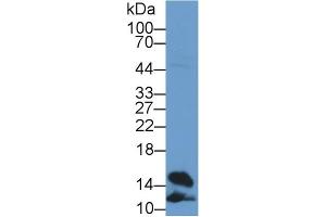 Detection of FABP4 in Rat Heart lysate using Polyclonal Antibody to Fatty Acid Binding Protein 4 (FABP4) (FABP4 anticorps  (AA 2-132))