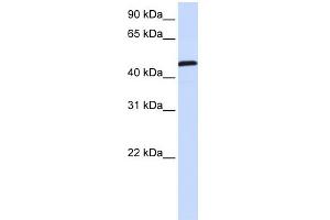 WB Suggested Anti-UMPS Antibody Titration:  0.
