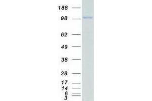 Validation with Western Blot