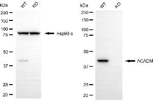 Western blotting analysis using ACADM antibody (ABIN7799352). (Recombinant Medium-Chain Specific Acyl-CoA Dehydrogenase, Mitochondrial (MCAD) anticorps)