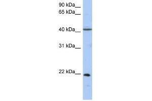 GUK1 antibody used at 1 ug/ml to detect target protein. (GUK1 anticorps  (Middle Region))