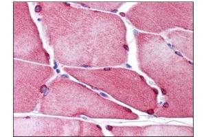Human Skeletal Muscle: Formalin-Fixed, Paraffin-Embedded (FFPE) (TMEM38A anticorps  (C-Term))