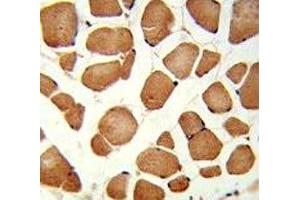 IHC analysis of FFPE human skeletal muscle stained with ANGPTL4 antibody
