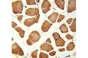 IHC analysis of FFPE human skeletal muscle stained with ANGPTL4 antibody (ANGPTL4 anticorps  (AA 138-167))