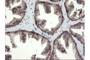 Image no. 1 for anti-Transmembrane Protein 173 (TMEM173) antibody (ABIN1501428)