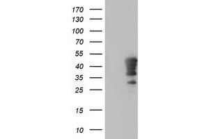 Western Blotting (WB) image for anti-Homeobox C11 (HOXC11) (AA 1-304) antibody (ABIN1490736) (HOXC11 anticorps  (AA 1-304))