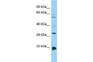 Host: Rabbit Target Name: CORO1B Sample Type: HepG2 Whole Cell lysates Antibody Dilution: 1. (CORO1B anticorps  (C-Term))