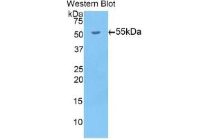 Detection of Recombinant bACE1, Mouse using Polyclonal Antibody to Beta-Site APP Cleaving Enzyme 1 (bACE1) (BACE1 anticorps  (AA 190-430))