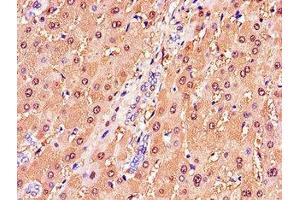 anti-Glutathione S-Transferase alpha 1 (GSTA1) (AA 2-222) antibody