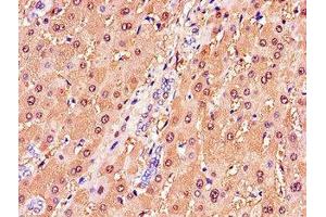 Immunohistochemistry of paraffin-embedded human liver tissue using ABIN7154085 at dilution of 1:100 (GSTA1 anticorps  (AA 2-222))