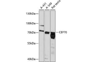 Western blot analysis of extracts of various cell lines, using CEP70 antibody (ABIN6129670, ABIN6138429, ABIN6138430 and ABIN6218042) at 1:3000 dilution.