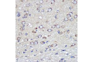 Immunohistochemistry of paraffin-embedded rat brain using JAM-A/CD321/F11R Rabbit pAb (ABIN3021822, ABIN3021823, ABIN3021824, ABIN1512881 and ABIN6216028) at dilution of 1:100 (40x lens).