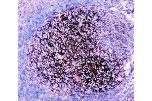 IHC-P: CD82 antibody testing of human tonsil tissue (CD82 anticorps  (AA 98-267))