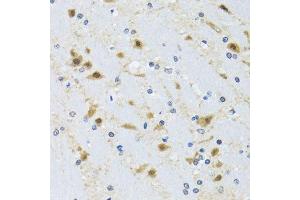Immunohistochemistry of paraffin-embedded mouse brain using CCT4 antibody.