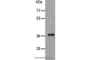 Western blot analysis of Human fetal muscle tissue, using PARD6A Polyclonal Antibody at dilution of 1:650