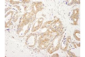 Immunohistochemistry (IHC) image for anti-DEAD (Asp-Glu-Ala-Asp) Box Polypeptide 6 (DDX6) (AA 1-50) antibody (ABIN7448524) (DDX6 anticorps  (AA 1-50))