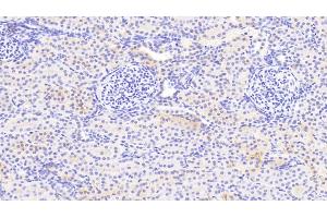 Detection of NDUFS1 in Human Kidney Tissue using Polyclonal Antibody to NADH Dehydrogenase Ubiquinone Fe-S Protein 1 (NDUFS1)