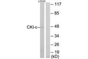 Western blot analysis of extracts from LOVO cells, using CKI-epsilon Antibody. (CK1 epsilon anticorps  (AA 276-325))