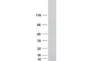 Validation with Western Blot