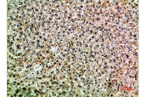Immunohistochemical analysis of paraffin-embedded human-liver, antibody was diluted at 1:200